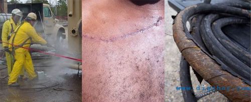 �߉���ϴ�C(j��)�����Б�(y��ng)ע��İ�ȫ��(w��n)�}